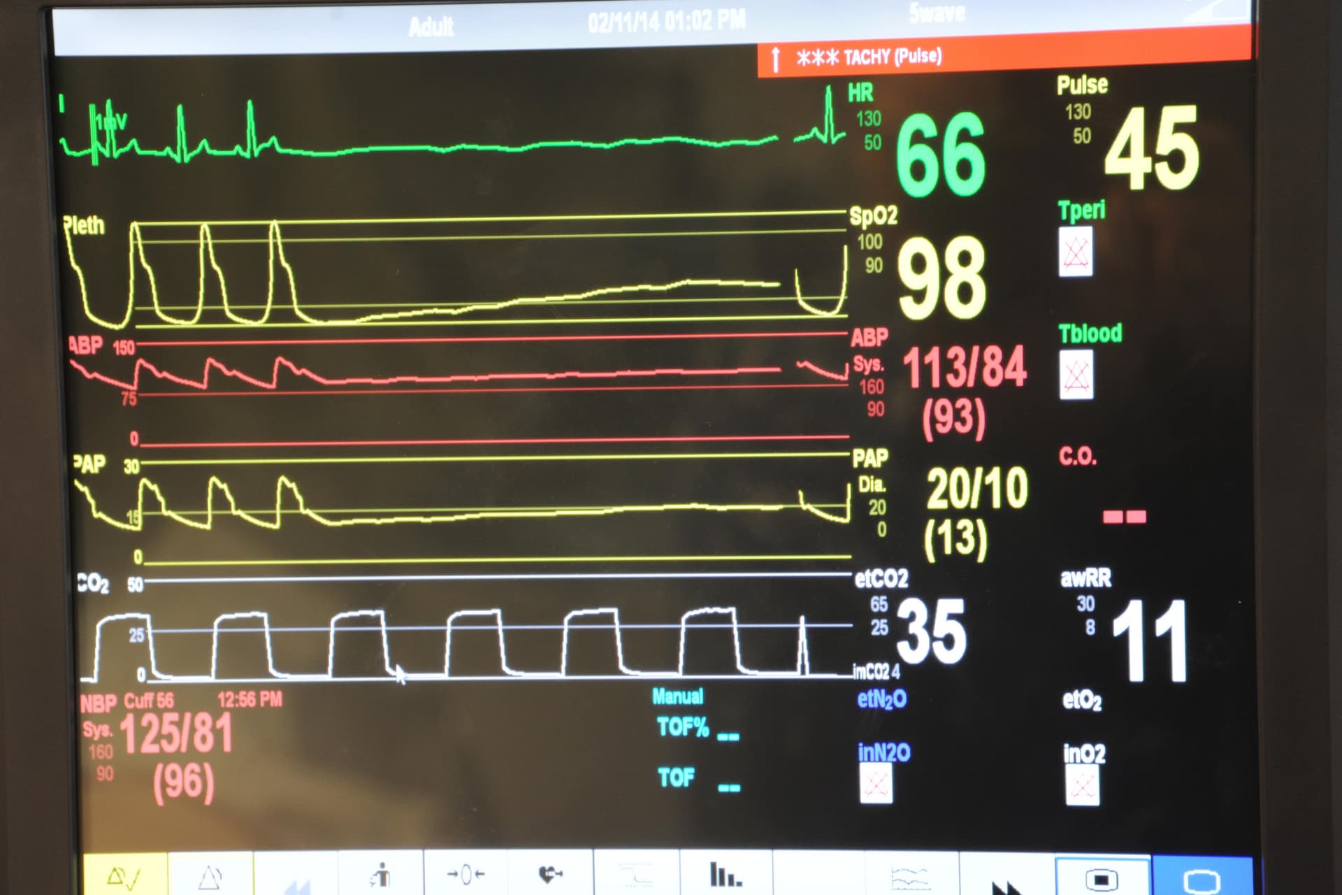Medical Equipment
