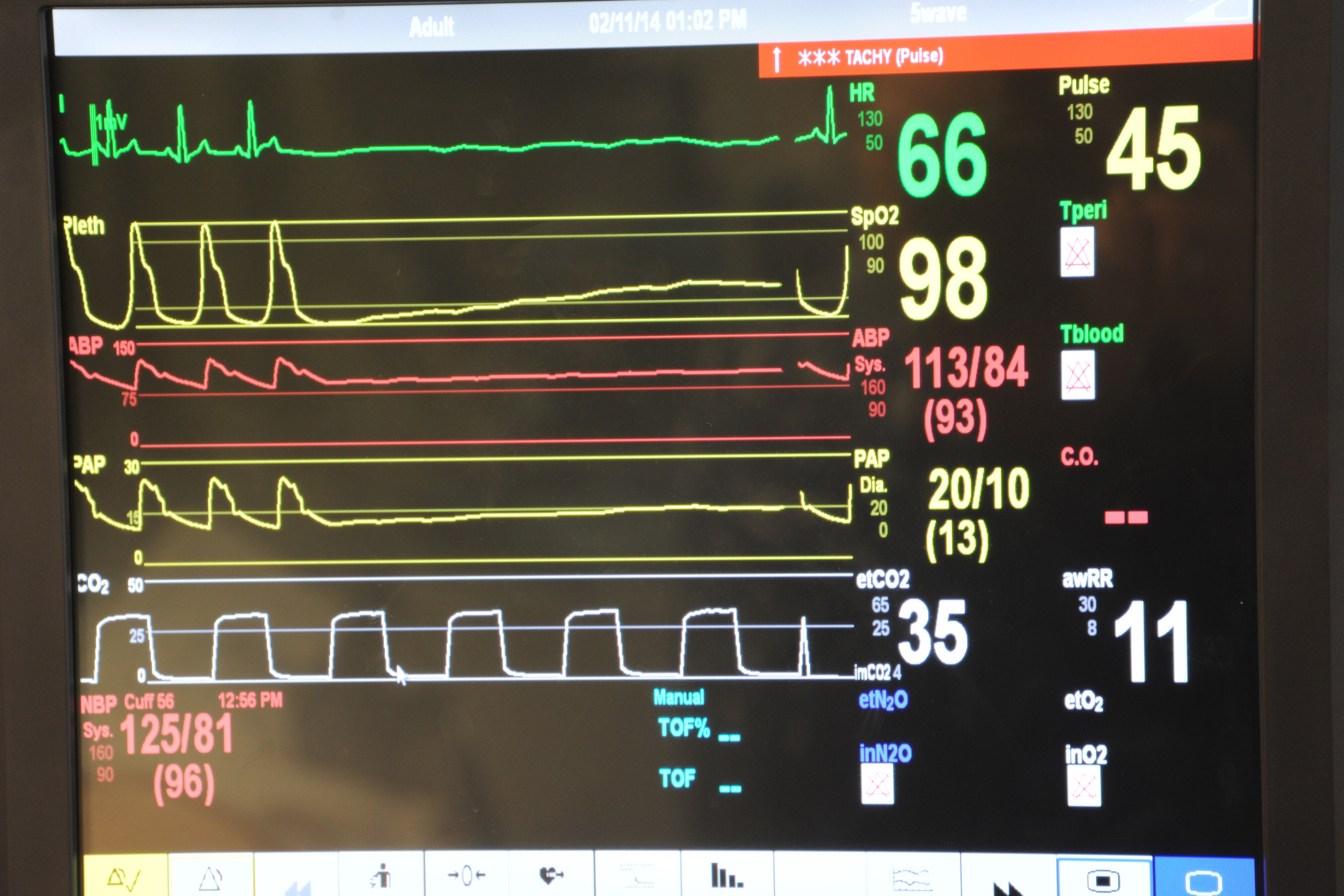 Medical Equipment
